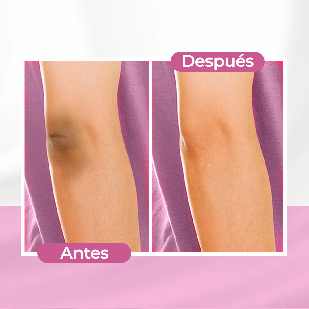 SKINGLOW CREMA ACLARANTE